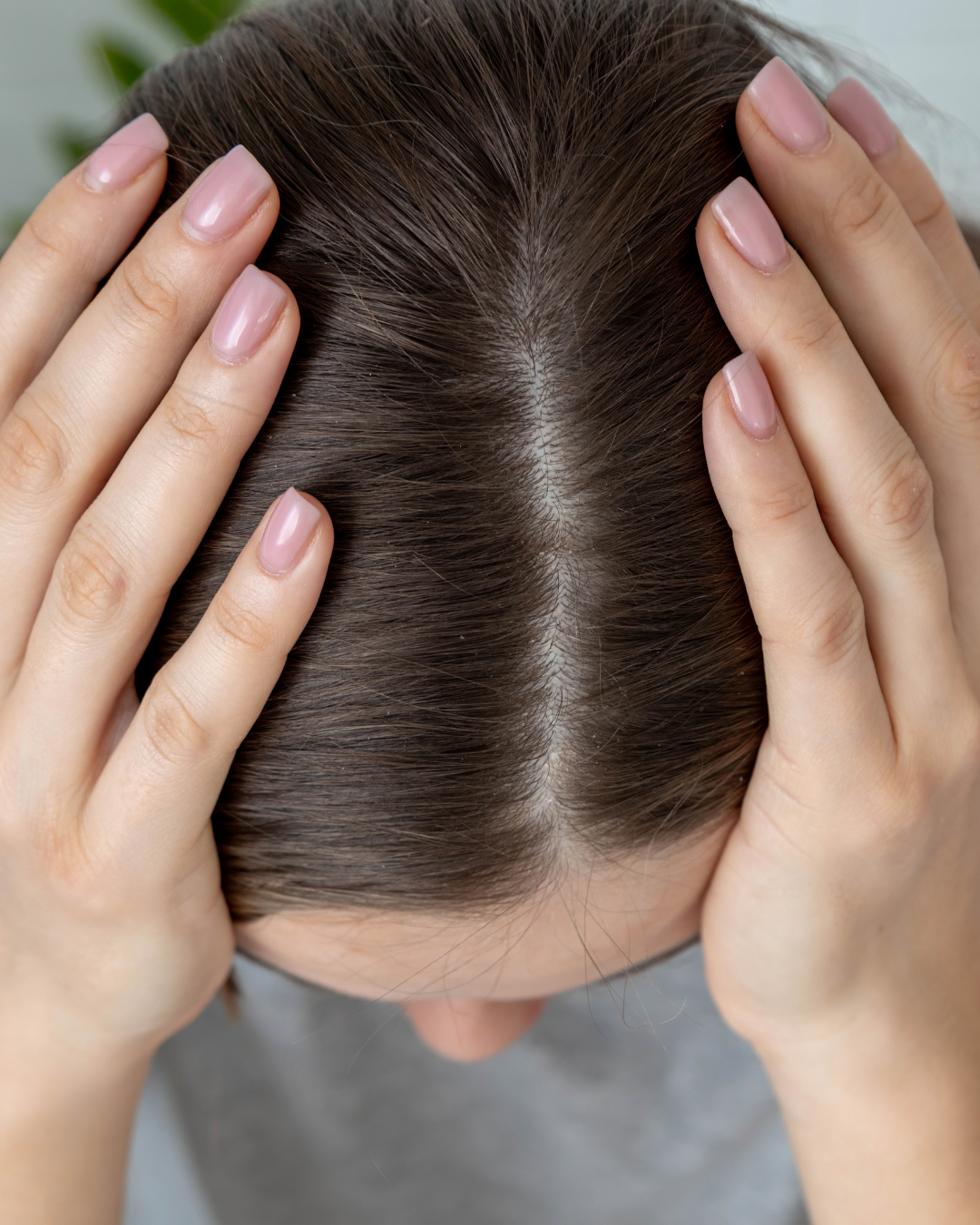 Cheveux qui tombent après un choc émotionnel